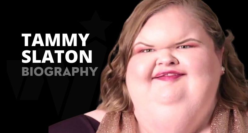 Tammy Slaton Weight, Net Worth, Surgery, Dead, Bio And Wiki